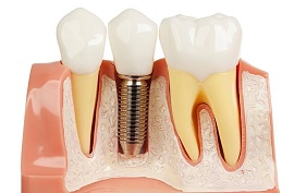 Treadent Diş Kliniği, Protez, İmplant, Ortodonti, Estetik Diş Hekimliği, Pedodonti, Restoratif(Dolgu) Tedavi, Endodontik(Kanal)Tedavi, Periodontoloji(Diş Eti) Tedavi, Hamilelikte Ağız Bakımı, Sedasyonla Diş Tedavisi, Cerrahi İşlemler