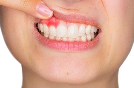 Treadent Diş Kliniği, Protez, İmplant, Ortodonti, Estetik Diş Hekimliği, Pedodonti, Restoratif(Dolgu) Tedavi, Endodontik(Kanal)Tedavi, Periodontoloji(Diş Eti) Tedavi, Hamilelikte Ağız Bakımı, Sedasyonla Diş Tedavisi, Cerrahi İşlemler